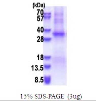 SDS-PAGE: Recombinant Human TSSK6 His Protein [NBP2-51648]