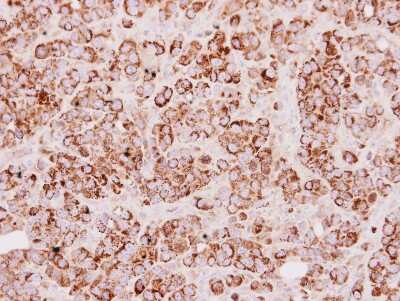 Immunohistochemistry-Paraffin: TST Antibody [NBP1-33771]