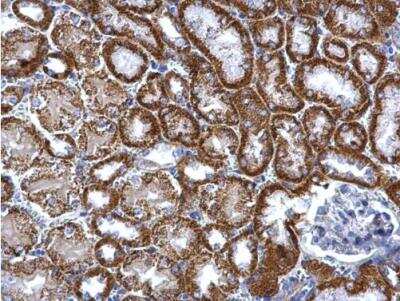 Immunohistochemistry-Paraffin: TST Antibody [NBP1-33771]