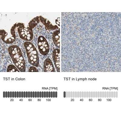 Immunohistochemistry-Paraffin: TST Antibody [NBP1-87147]