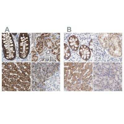 Immunohistochemistry-Paraffin: TST Antibody [NBP1-87147]