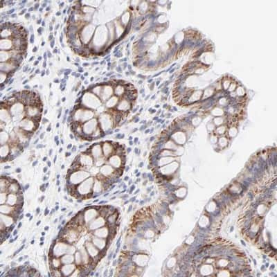 Immunohistochemistry-Paraffin: TST Antibody [NBP1-87148]