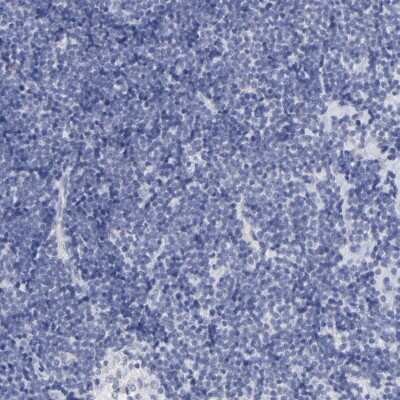 Immunohistochemistry-Paraffin: TST Antibody [NBP1-87148]
