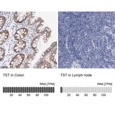 Immunohistochemistry-Paraffin: TST Antibody [NBP1-87148]