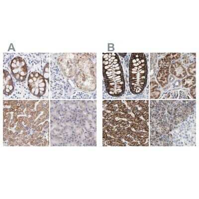 Immunohistochemistry-Paraffin: TST Antibody [NBP1-87148]