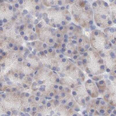 Immunohistochemistry-Paraffin: TST Antibody [NBP1-87148]
