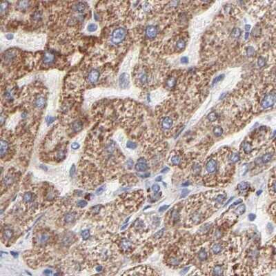 Immunohistochemistry-Paraffin: TST Antibody [NBP1-87148]