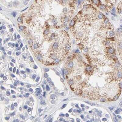 Immunohistochemistry-Paraffin: TST Antibody [NBP1-87148]