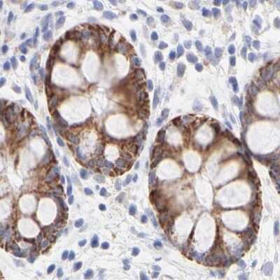 Immunohistochemistry-Paraffin: TST Antibody [NBP1-87148]