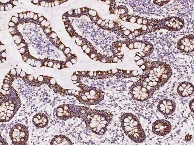 Immunohistochemistry-Paraffin: TST Antibody [NBP2-98573]