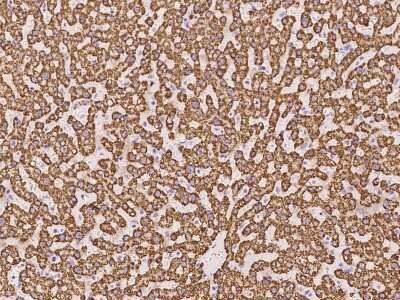 Immunohistochemistry-Paraffin: TST Antibody [NBP2-98573]