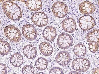 Immunohistochemistry-Paraffin: TST Antibody [NBP2-99639]