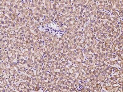 Immunohistochemistry-Paraffin: TST Antibody [NBP2-99639]