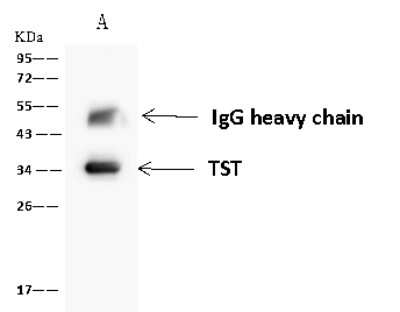 Immunoprecipitation: TST Antibody [NBP2-98573]