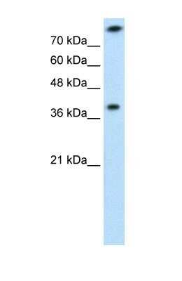 Western Blot: TST Antibody [NBP1-54682]