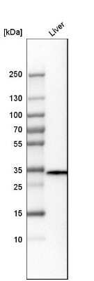 Western Blot: TST Antibody [NBP1-87148]