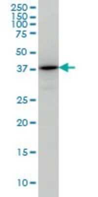 Western Blot: TSTA3 Antibody (2B9) [H00007264-M01]