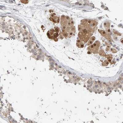 Immunohistochemistry-Paraffin: TSTA3 Antibody [NBP1-83408]