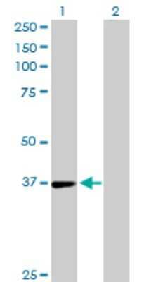 Western Blot: TSTA3 Antibody [H00007264-D01P]