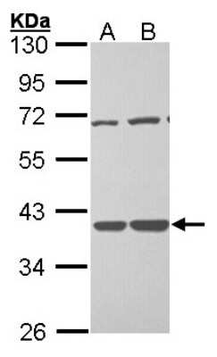 Western Blot: TSTA3 Antibody [NBP1-33070]