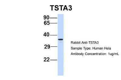 Western Blot: TSTA3 Antibody [NBP1-59130]