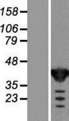 Western Blot: TSTA3 Overexpression Lysate [NBL1-17396]