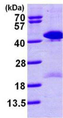 Western Blot: Recombinant Human TSTA3 His Protein [NBP1-45309]