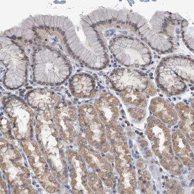 Immunohistochemistry-Paraffin: TSTD1 Antibody [NBP1-81566]
