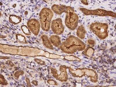 Immunohistochemistry-Paraffin: TSTD1 Antibody [NBP2-98187]