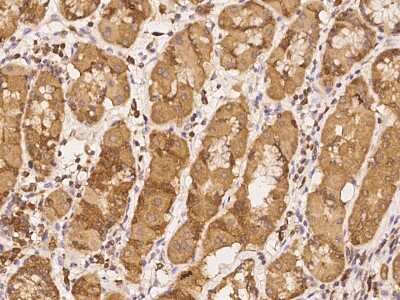 Immunohistochemistry-Paraffin: TSTD1 Antibody [NBP2-98187]