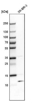 Western Blot: TSTD1 Antibody [NBP1-81566]