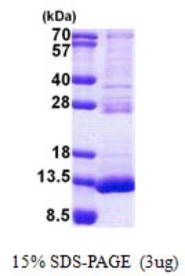 SDS-PAGE: Recombinant Human TSTD3 His Protein [NBP2-22862]