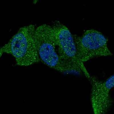 Immunocytochemistry/ Immunofluorescence: TTBK1 Antibody [NBP2-55410]