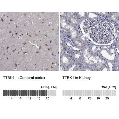 Immunohistochemistry-Paraffin: TTBK1 Antibody [NBP1-82888]