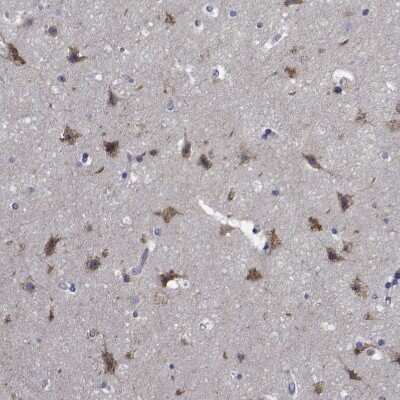 Immunohistochemistry-Paraffin: TTBK1 Antibody [NBP1-82888]