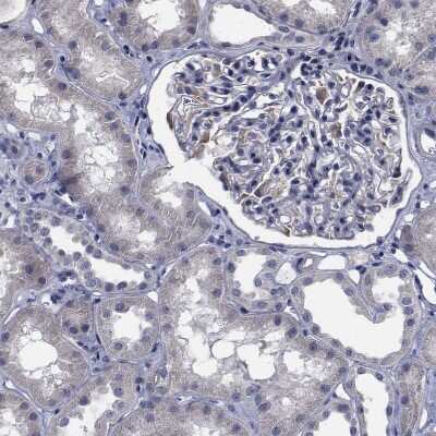 Immunohistochemistry-Paraffin: TTBK1 Antibody [NBP1-82888]