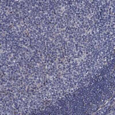 Immunohistochemistry-Paraffin: TTBK1 Antibody [NBP1-82888]