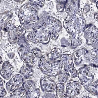 Immunohistochemistry-Paraffin: TTBK1 Antibody [NBP1-82888]