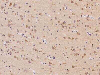 Immunohistochemistry-Paraffin: TTBK1 Antibody [NBP3-06356]