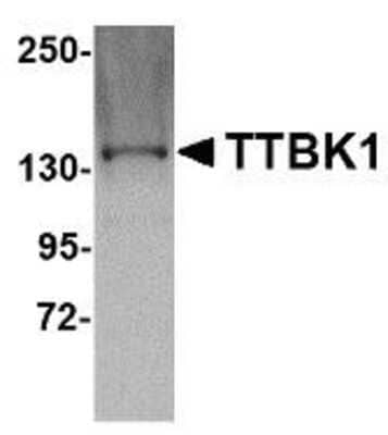 Western Blot: TTBK1 AntibodyBSA Free [NBP1-76989]