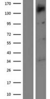 Western Blot: TTBK1 Overexpression Lysate [NBP2-06008]