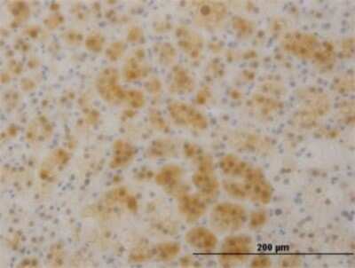 Immunohistochemistry-Paraffin: TTC1 Antibody (4E3) [H00007265-M01]