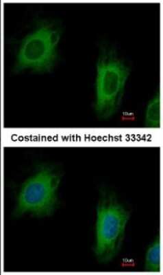 Immunocytochemistry/ Immunofluorescence: TTC1 Antibody [NBP1-30972]