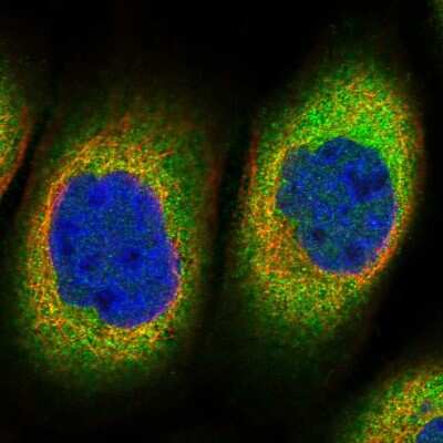 Immunocytochemistry/ Immunofluorescence: TTC1 Antibody [NBP1-86921]