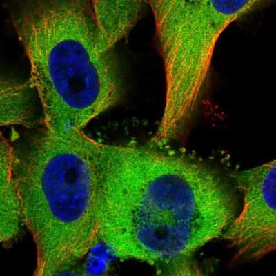 Immunocytochemistry/ Immunofluorescence: TTC1 Antibody [NBP2-57145]