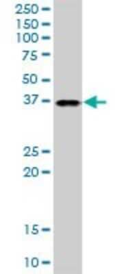 Western Blot: TTC1 Antibody [H00007265-B01P]