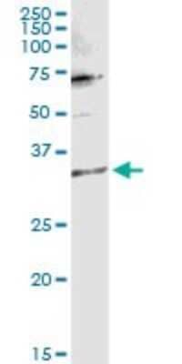 Western Blot: TTC1 Antibody [H00007265-D01P]