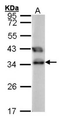 Western Blot: TTC1 Antibody [NBP1-30972]