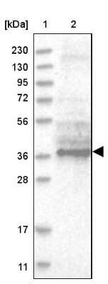 Western Blot: TTC1 Antibody [NBP1-86921]