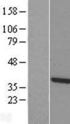 Western Blot: TTC1 Overexpression Lysate [NBL1-17397]